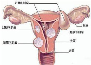 外阴炎怎么治疗好