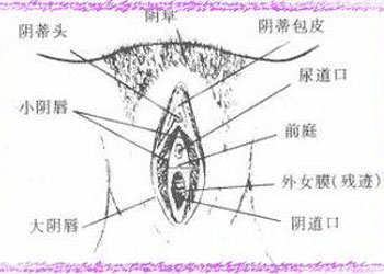 外阴炎如何治疗