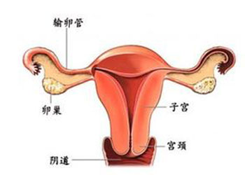 附件炎是怎么引起的