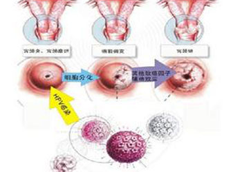 白带多有异味是怎么回事